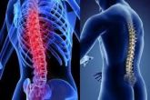 Fisioterapia na Coluna Torácica e Lombar