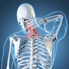 Fisioterapia na Coluna Cervical