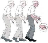 Fisioterapia no Mal de Parkinson