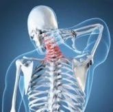 Fisioterapia na Coluna Cervical