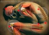 Fisioterapia em 4 Membros